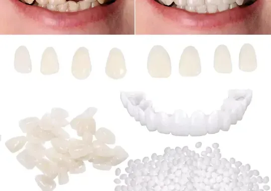 Brige-Tooth-Repair-Kit